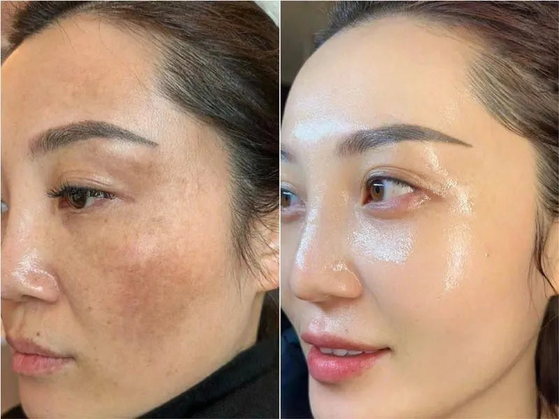 Bio-Collagen Mask (5x)